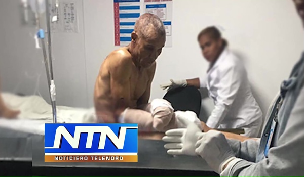 Propietario de finca amputa dos manos a un hombre tras sorprenderlo robando plátanos en SFM.