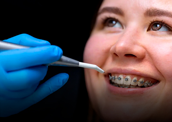 Esta es la razón por la que no deberías usar antiinflamatorio para el dolor de la ortodoncia