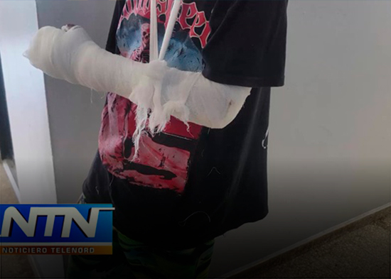 Joven denuncia fue atropellado y dejado abandonado por el conductor del vehiculo