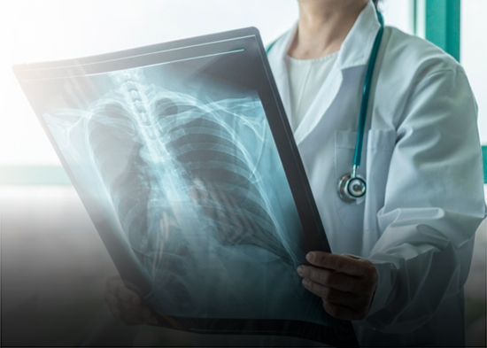 Lo que el neumólogo necesita saber para cuidar tus pulmones