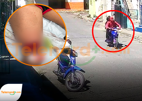 Desaprensivos hieren niño de 10 años en la calle Gastón F Delingne de SFM