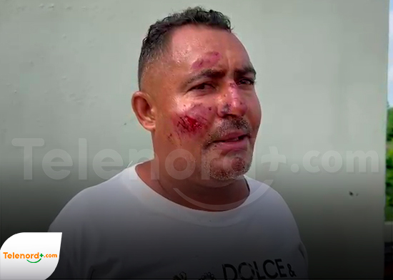 Hombre resulta herido tras ser atropellado; denuncia conductor lo dejó abandonado